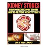kidney stones how to treat kidney stones how to prevent kidney stones