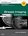 Breast Imaging: Case Review Series