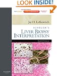 Scheuer's Liver Biopsy Interpretation...