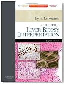 Scheuer's Liver Biopsy Interpretation 9e: Expert Consult: Online and Print, 8e