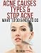 Acne Causes Types & Stop Acne : What to Do & Not to Do