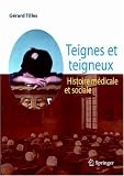 Teignes et teigneux