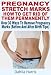 Pregnancy Stretch Marks : How To Get Rid Of Them Permanently Over 30 Ways To Remove Pregnancy Marks (Before And After Birth Tips)