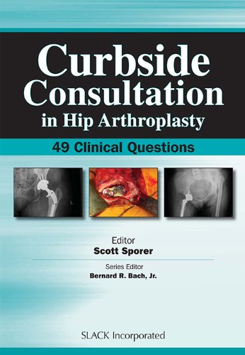 curbside consultation in hip arthroplasty 49 clinical questions