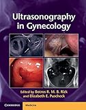 Ultrasonography in gynecology