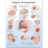Dangers of Smoking Anatomical Chart in Spanish (Peligros del tabaquismo)