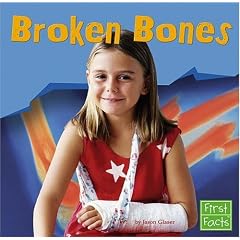 Broken Bones (First Facts)