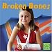 Broken Bones (First Facts)