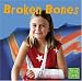 Books : Broken Bones (First Facts)