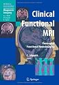 Clinical Functional MRI: Presurgical Functional Neuroimaging
