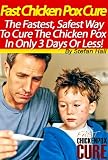כיצד לרפא אבעבועות רוח How to cure chicken pox