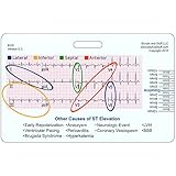 STEMI 12 Lead Tool Horizontal Reference Badge ID Card (1 Card)
