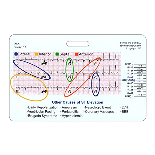 STEMI 12 Lead Tool Horizontal Reference Badge ID Card (1 Card) - Want ...
