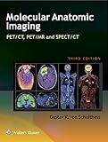 Molecular anatomic imaging : PET-CT, PET-MR, and SPECT-CT