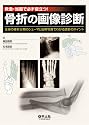 救急・当直で必ず役立つ!骨折の画像診断―全身の骨折分類のシェーマと症例写真でわかる読影のポイント