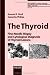 The Thyroid: Fine-Needle Biopsy and Cytological Diagnosis of Thyroid Lesions (Monographs in Clinical Cytology)