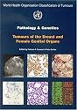 World Health Organization: Tumours of the Breast and Female Genital Organs (Who/IARC Classification of Tumours) (IARC WHO Classification of Tumours)