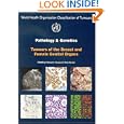 World Health Organization: Tumours of the Breast and Female Genital Organs (Who IARC Classification of Tumours) (Who... by Fattaneh A. Tavassoli and Peter Devilee