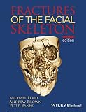 Fractures of the facial skeleton