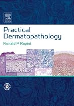 Practical Dermatopathology: Textbook with CD-ROM