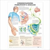 Understanding Parkinson's Disease Anatomical Chart