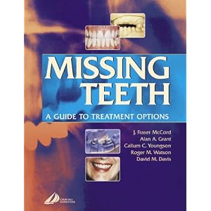 Click here to buy Missing Teeth: A Guide to Treatment Options by J. Fraser McCord DDS BDS RCS(Edin) C(BIOL) MI(BIOL), Alan A. Grant DDSc MSc FRACDS, Callum Y. Youngson, and Roger M. Watson.