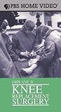 Implant II: Knee Replacement Surgery [VHS]