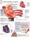 Understanding Angina