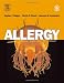Allergy