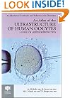An Atlas of the Ultrastructure of Human Oocytes: A Guide for Assisted Reproduction (Encyclopedia of Visual Medicine Series)