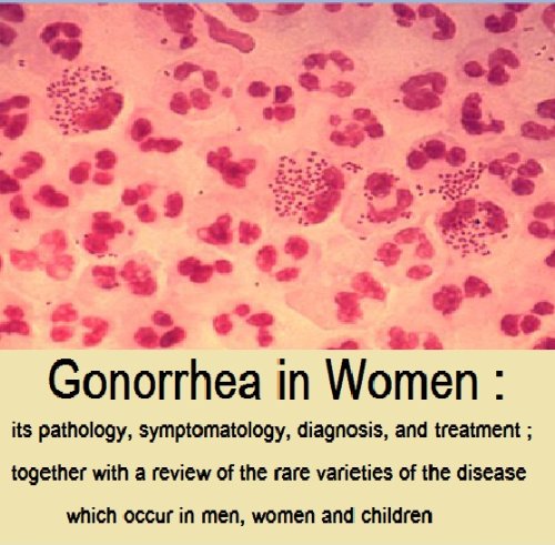gonorrhea treatment
