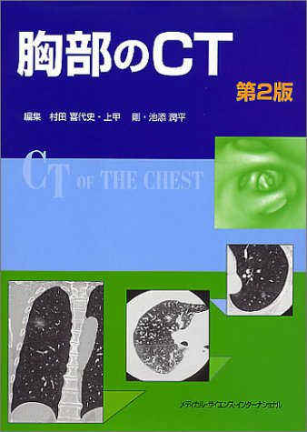 ������CT