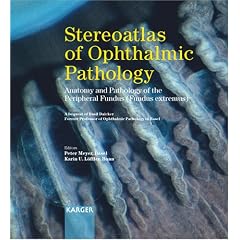 Stereoatlas of Ophthalmic Pathology: Anatomy and Pathology of the Peripheral Fundus (fundus Extremus), A Bequest of Basil Daicker, Former Professor of ... Professor of Ophthalmic Pathology in Basel