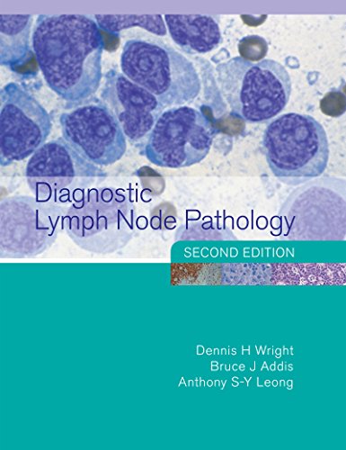 Diagnostic Lymph Node Pathology, 2nd Edition