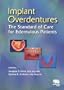 Implant Overdentures: The Standard of Care for Edentulous Patients