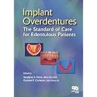Click here to buy Implant Overdentures: The Standard of Care for Edentulous Patients by Jocelyne S. Feine and Gunnar E. Carlsson.