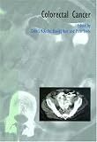 51AH7A975KL. SL160  Colorectal Cancer