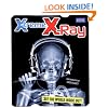 X-treme X-ray