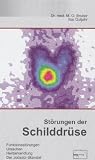St&ouml;rungen der Schilddr&uuml;se: Was man &uuml;ber die Schilddr&uuml;se wissen sollte - St&ouml;rungen, Ursachen, Heilbehandlung, Warnung vor jodiertem Salz - Max Otto Bruker, Ilse Gutjahr