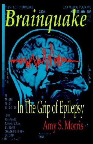 Epilepsy