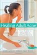 Healing Adult Acne: Your Guide to Clear Skin and Self-Confidence