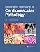 Illustrated Textbook of Cardiovascular Pathology