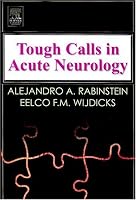 Tough Calls in Acute Neurology