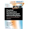 Practical Perioperative Transesophageal Echocardiography: Text with DVD-ROM, 2e