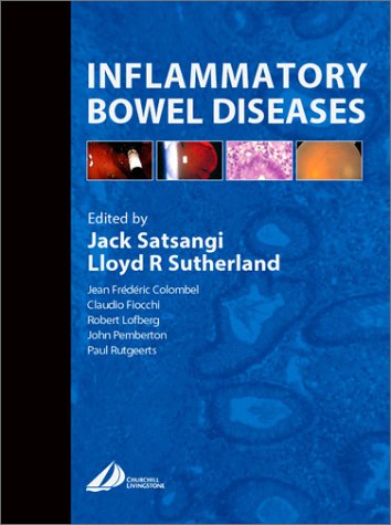 Inflammatory-Bowel-Disease