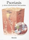  : Psoriasis y Otras Dematosis Frecuentes (Miniatlas)