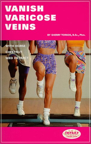 Varicose-Veins
