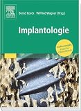 Praxis der Zahnheilkunde - Implantologie