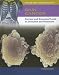 Skin Cancer: Current And Emerging Trends in Detection And Treatment (Cancer and Modern Science)