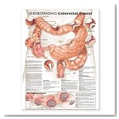 Understanding Colorectal Cancer Anatomical Chart